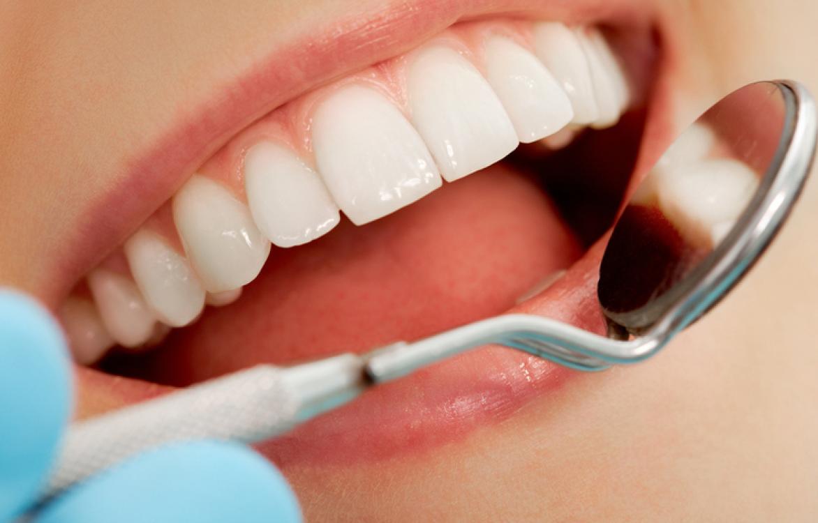 Voeding gezonde tanden
